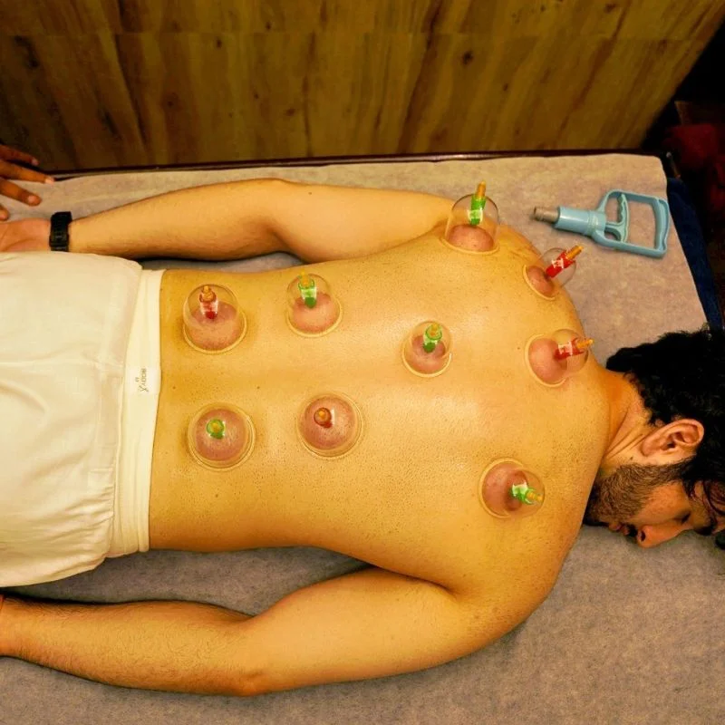 Acupuncture therapy at The Neeraj Ganga Wellness Retreat in Rishikesh